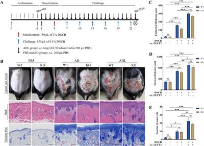 Role of LECT2 in exacerbating atopic dermatitis: insight from in vivo and in vitro models via NF-κB signaling pathway